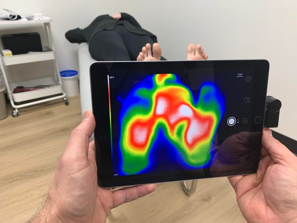 Neuropathy study