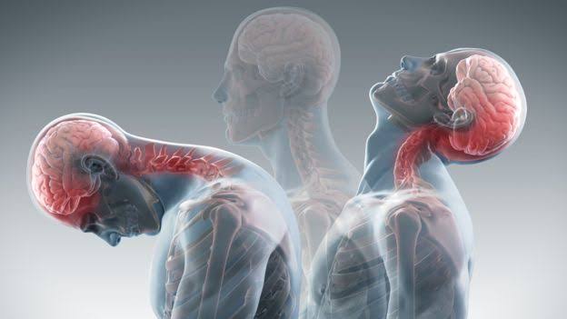 Auto Accident Chiropractic
