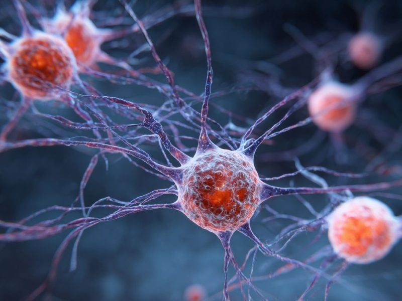 Chronic Neuropathy