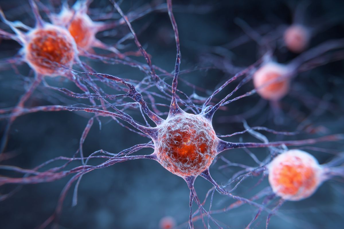 Medical illustration of nerve cells associated with chronic neuropathy