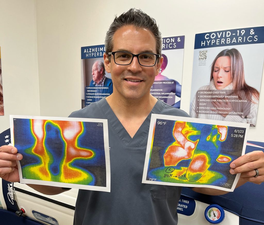 Neuropathy result