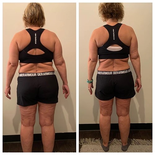 Side-by-side progress photographs from a weight loss program