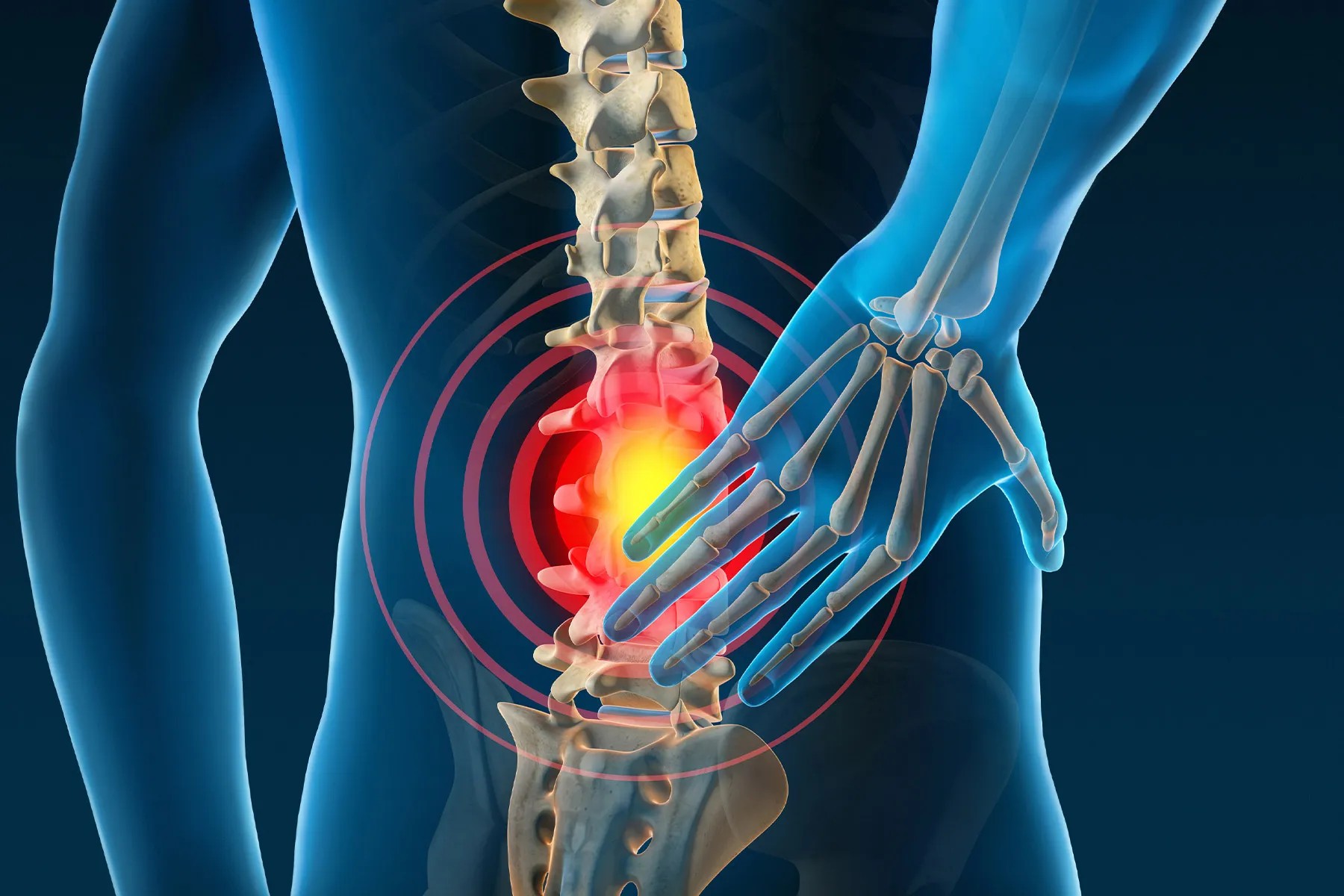 Anatomical illustration highlighting lower back pain