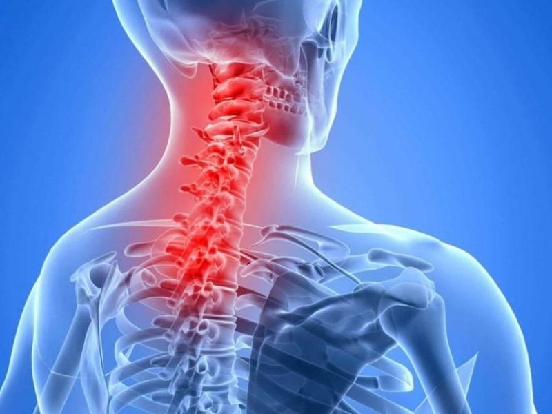 Neck Pain