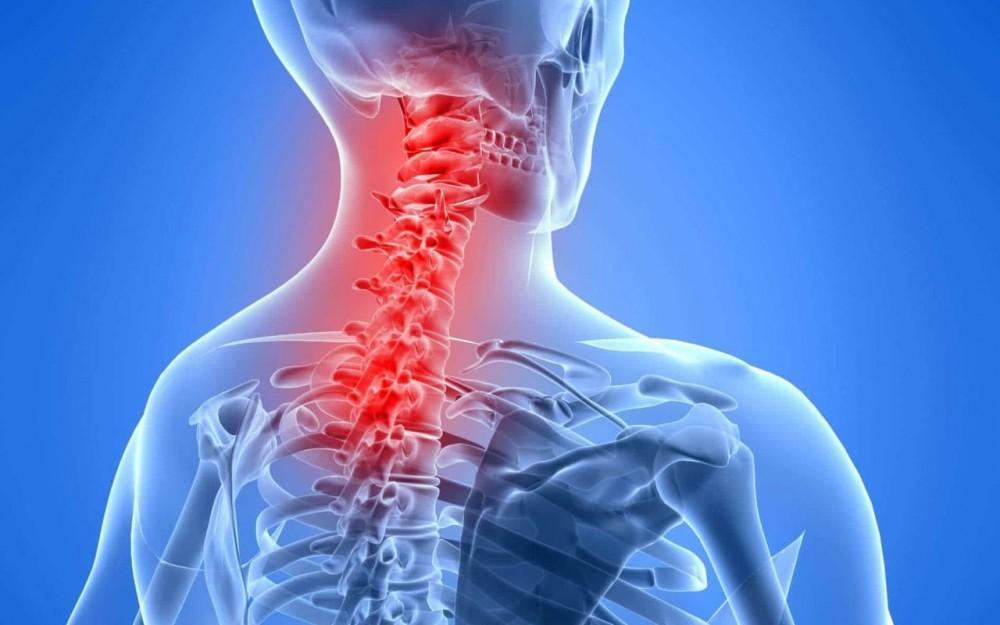 Anatomical illustration highlighting neck pain