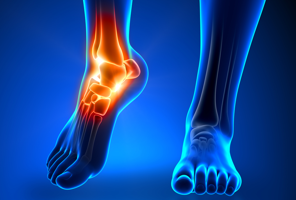 Patient receiving care for foot pain