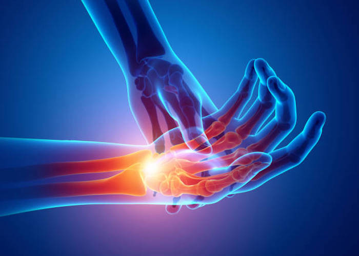 Patient receiving care for hand pain